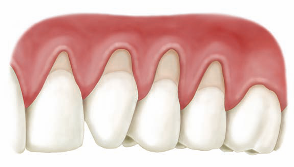 periodontist queens